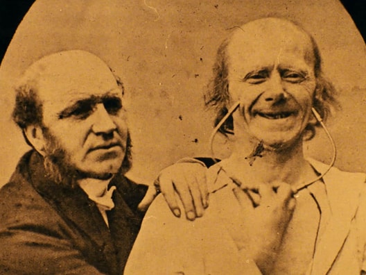 L'Expression des passions : Duchenne de Boulogne (1806-1876)